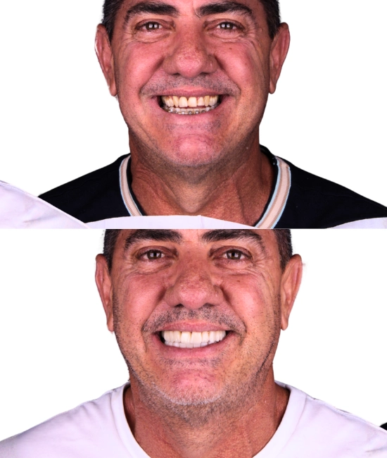 ft-antes-e-depois-13-OK.webp