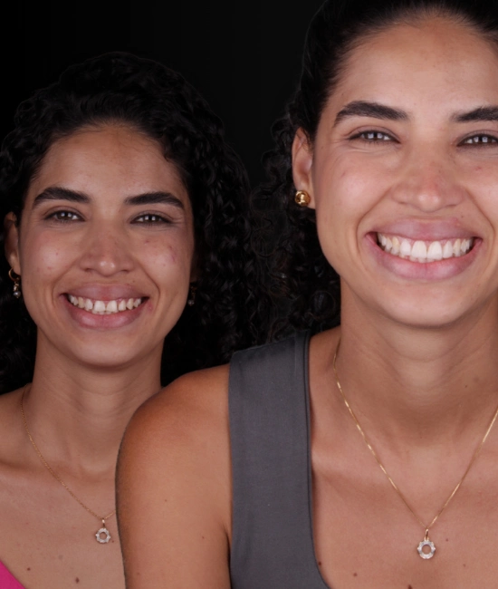 ft-antes-e-depois-3-OK.webp