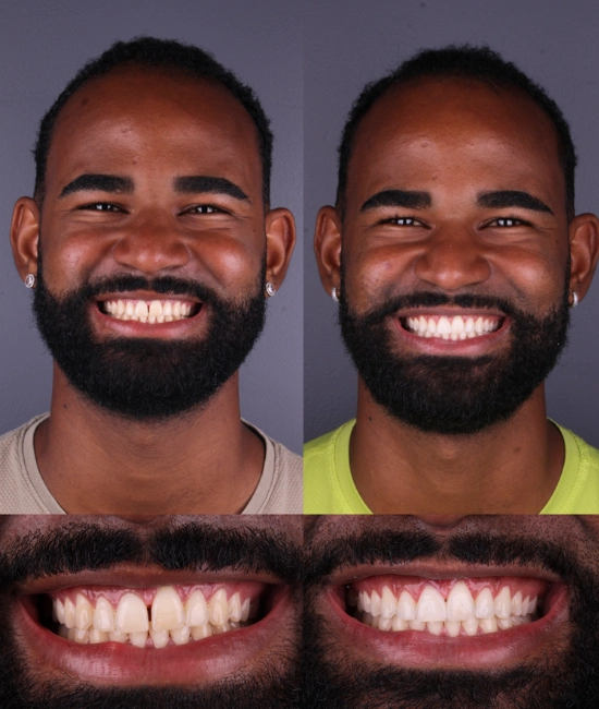 ft-antes-e-depois-4-OK.webp