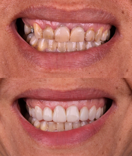 ft-antes-e-depois-5-OK.webp