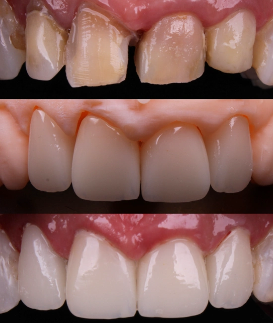 ft-antes-e-depois-7-OK.webp